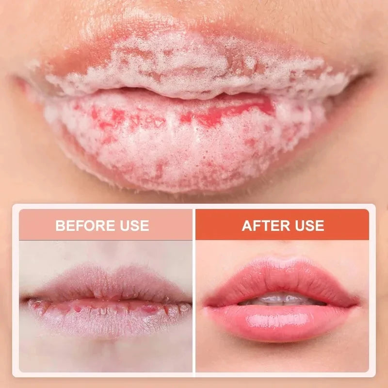 Bubble Lip Mask Moisturizer